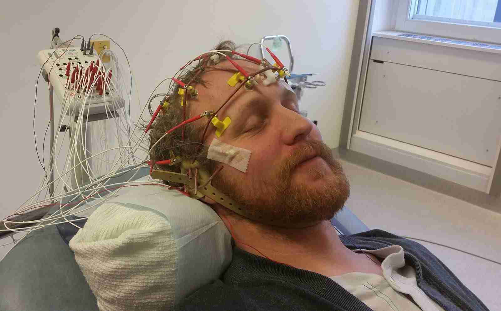 ​Electroencephalography Definition Vision One